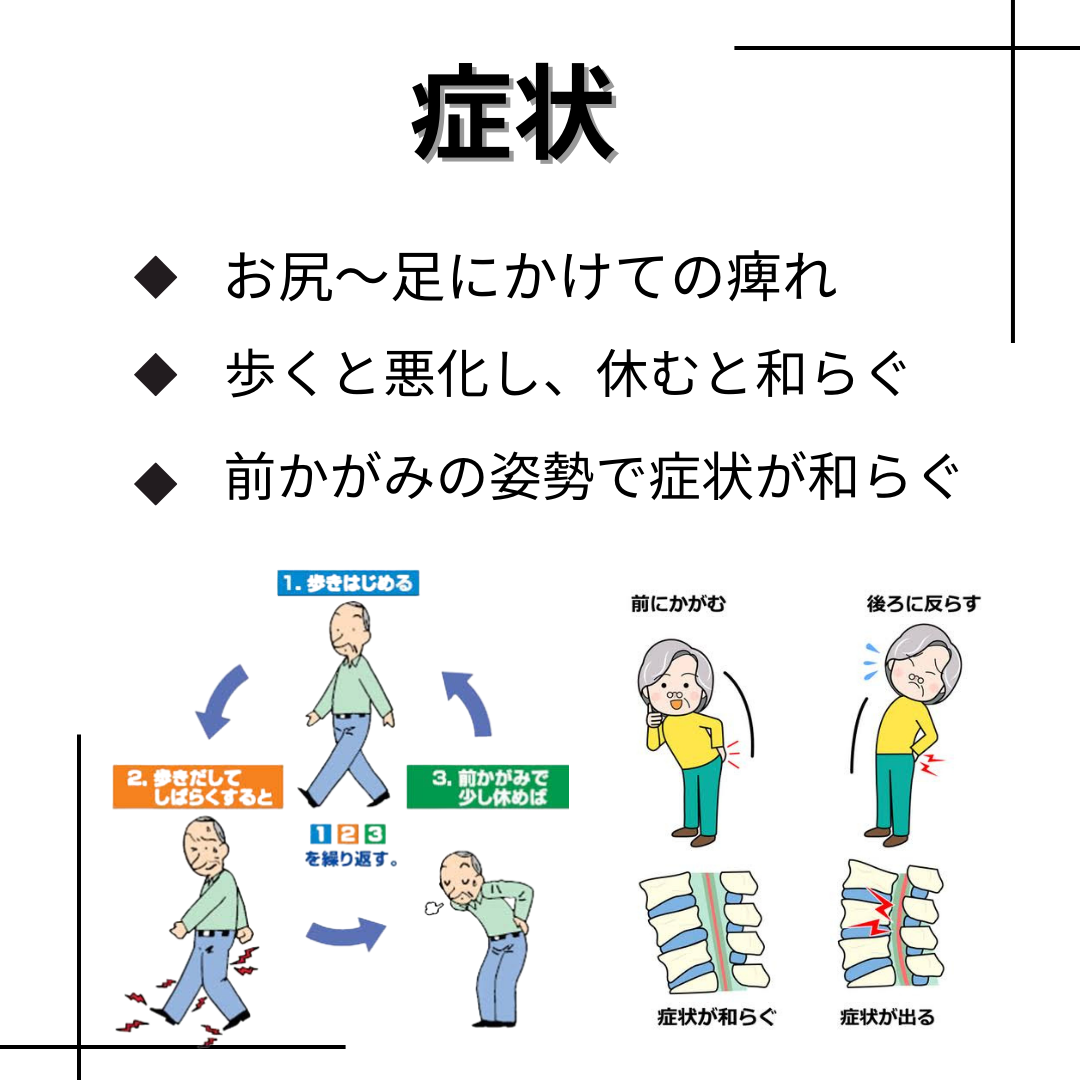 歩く と 腰 が 痛い
